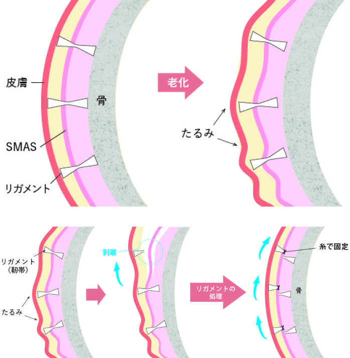 サンプル画像